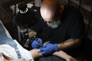 Remoção de Tatuagem a Laser